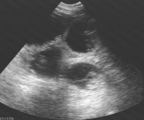 Ultrasound-2-Cropped